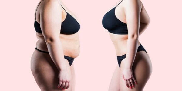 Navigating Liposuction: Unmasking Potential Side Effects and Mitigation Strategies