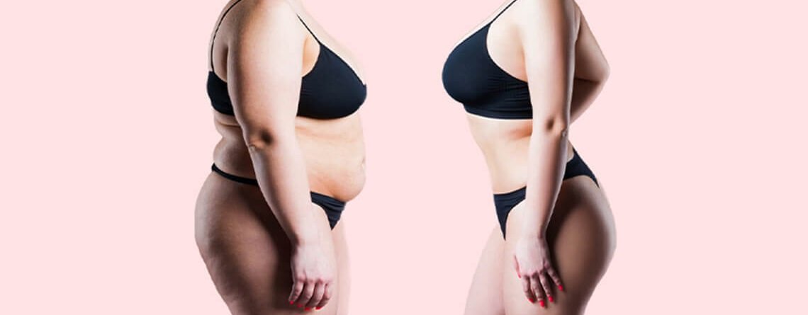 Navigating Liposuction: Unmasking Potential Side Effects and Mitigation Strategies